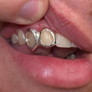 Dubbel open raam, Vampire Fang Cap– Custom Made goud- en zilvergrillz | Gepersonaliseerde Grillz-sets GRATIS malkit + gratis verzending!