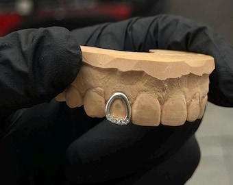 Iced Out Diamond Tip Open Face Window Cap– Custom Made Gold & Silver Grillz | Personalized Grillz Sets FREE Mold Kit + Free Shipping!