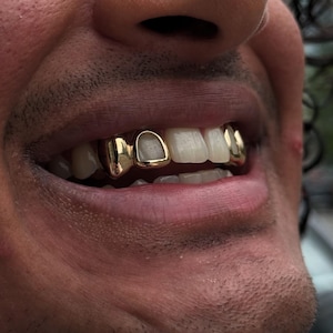 Open Face Window And Plain Gold Caps (4 Teeth)– Custom Made Gold & Silver Grillz | Personalized Grillz Sets FREE Mold Kit + Free Shipping!