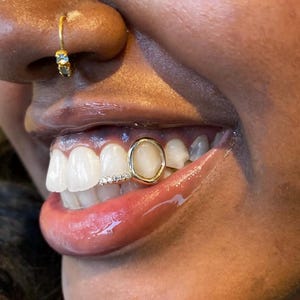 Open Face Window Diamond Inlay Cap– Custom Made Gold & Silver Grillz | Personalized Grillz Sets FREE Mold Kit + Free Shipping!