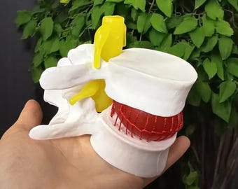 Unique Handmade Human Anatomy Skeleton Model — Spine & Lumbar Herniation Medical Teaching Model with Brain, Skull, Nerves, Educational Tools