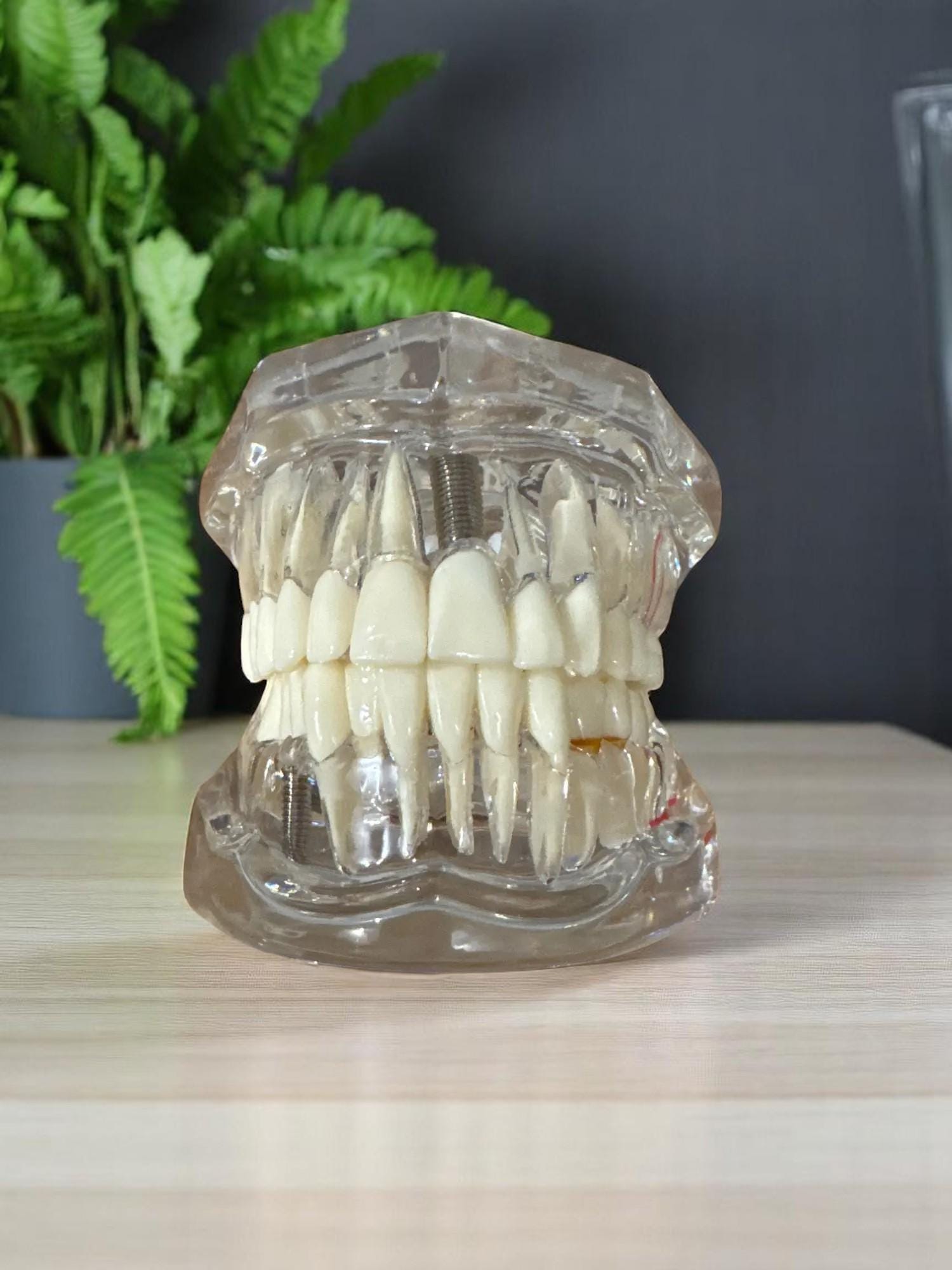 Kit Trapani Per Impianti Dentali ANZ - Organizzatore Compatto Per Professionisti