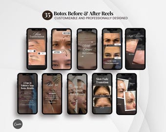 Botox Before & After Reels: Social Media Content for Canva (Digital Download), Nurse Injector | Medspa Video Reels.