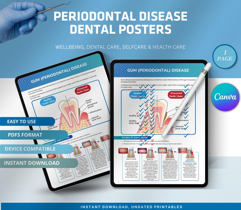 Periodontal Disease Dental Poster, Gum Health Patient Education Chart ...