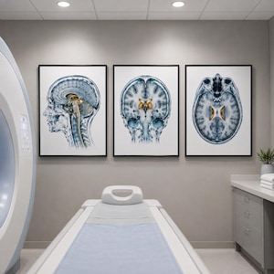 May include: Three framed wall art prints featuring medical brain scans in shades of blue, white, and gold. The left print shows a sagittal view, the center print shows a coronal view, and the right print shows an axial view of the human brain.