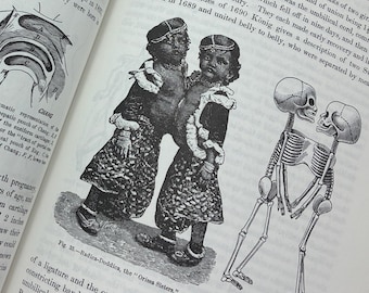 1980s Medical Encyclopedia of Rare Abnormalities Birth Defects - For Prop, Oddities Curiosities Medical Book Collection