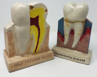 SALE! Set of 2 Big Tooth Models Advertising Dental Decay Molar for Dentist Office or Oddities Collection