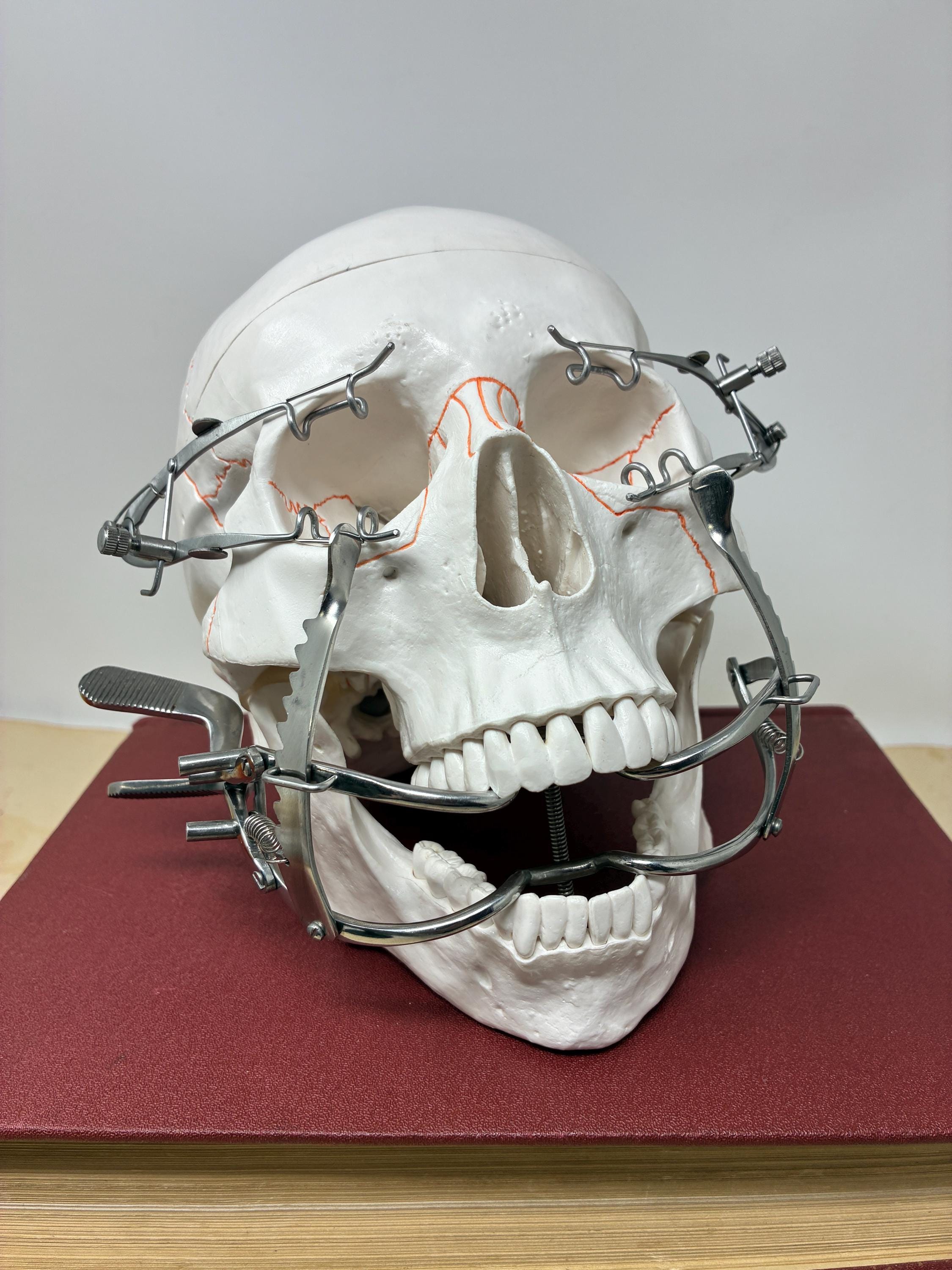 Partial denture - Etsy Schweiz