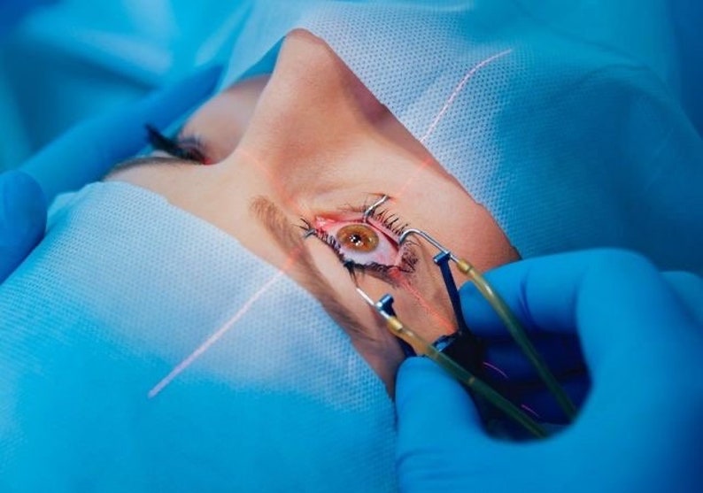 May include: Close-up of a person's eye during an eye surgery procedure. A surgical tool is being used to hold the eyelid open, and a laser beam is visible.