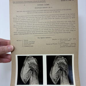 Puede incluir: Una ilustración anatómica antigua del Atlas estereoscópico de anatomía de Edimburgo, Sección IV, No. 17. La imagen presenta texto que describe la extremidad superior y dos imágenes estereoscópicas en blanco y negro de la región escapular.