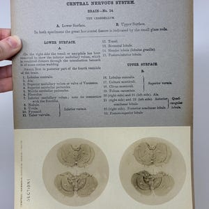 May include: Anatomy illustration from the Edinburgh Stereoscopic Atlas of Anatomy, Section 1, No. 24. The image shows a detailed diagram of the central nervous system, specifically the brain's cerebellum, with labels and descriptions. The image is in black and white.