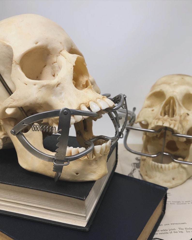 May include: Two human skulls with metal dental instruments attached. One skull is open, revealing teeth, and the other is closed. The skulls rest on a stack of books and a vintage anatomical illustration.