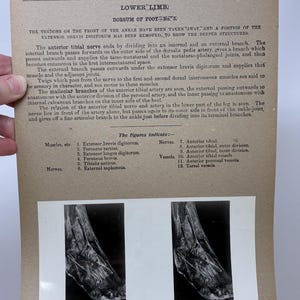 May include: Anatomy illustration from the Edinburgh Stereoscopic Atlas of Anatomy. The image shows a detailed black and white photograph of the lower limb, specifically the dorsum of the foot. Text includes anatomical terms and labels.