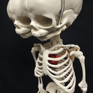 Réplique de squelette humain fœtal de jumeaux siamois sur pied avec véritable crâne triclops coeur d'animal image 1