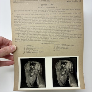 Könnte beinhalten: Anatomiediagramm aus dem Edinburgh Stereoscopic Atlas of Anatomy, Oberer Arm, Scapular Region - Nr. 3. Das Bild zeigt zwei Schwarz-Weiß-Fotografien eines Schultergelenks mit Beschriftungen und Text auf beigem Hintergrund.