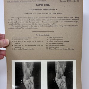 May include: Anatomy illustration from "The Edinburgh Stereoscopic Atlas of Anatomy" showing a detailed view of the knee joint with tendons. The text describes the knee joint's structure and the tendons involved. Section VIII, No. 10.