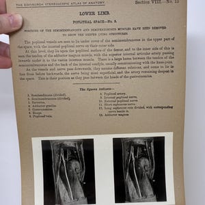 May include: Anatomy chart from the Edinburgh Stereoscopic Atlas of Anatomy, Section VIII, No. 15, focusing on the lower limb and popliteal space. The chart includes text and illustrations of the muscles, vessels, and nerves of the knee. The image is in black and white.