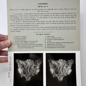 May include: Anatomy atlas page featuring a black and white stereoscopic image of a pelvis, labeled "Abdomen, Pelvis No. 8." The page includes detailed text describing anatomical structures and a list of figures.