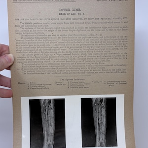 May include: Anatomy illustration from the Edinburgh Stereoscopic Atlas of Anatomy, showing the back of the lower leg. The image includes text and detailed diagrams of muscles, vessels, and nerves.