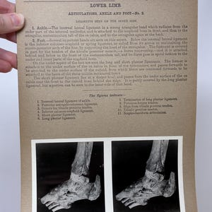 May include: Anatomy illustration from the Edinburgh Stereoscopic Atlas of Anatomy, Section VIII, No. 31. The image shows a detailed view of the lower limb, focusing on the ankle and foot, with labeled ligaments and tendons. The image is in black and white.