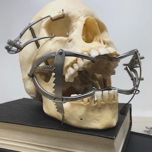 May include: A human skull with a metal surgical instrument attached, resting on a stack of old books. The skull is off-white, with visible teeth. The instrument has a complex design with springs and adjustable parts.