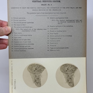 May include: An antique anatomical illustration from the Edinburgh Stereoscopic Atlas of Anatomy, Section I, No. 15. The image features a detailed diagram of the central nervous system, specifically the brain, with labels and a diagram of the brain.