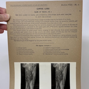 May include: Anatomy chart from the Edinburgh Stereoscopic Atlas of Anatomy, Section VIII, No. 4. The chart focuses on the lower limb, specifically the back of the thigh, with detailed illustrations of muscles and nerves. The text includes labels and descriptions.
