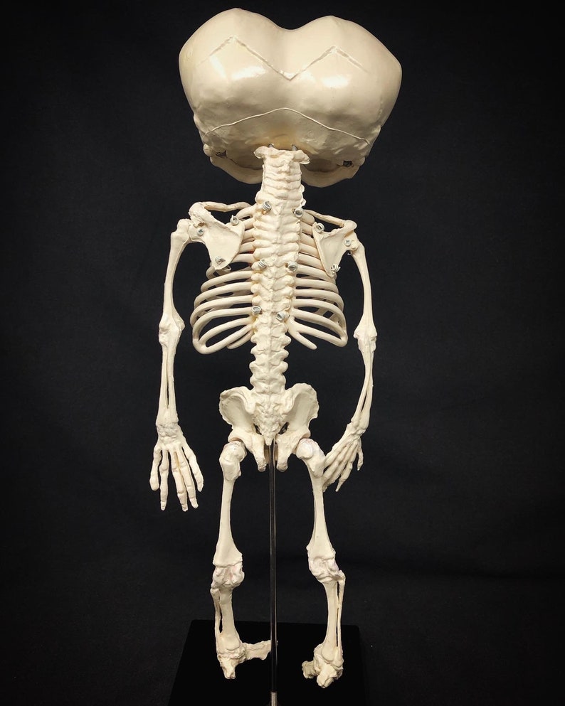 Réplique de squelette humain fœtal de jumeaux siamois sur pied avec véritable crâne triclops coeur d'animal image 9