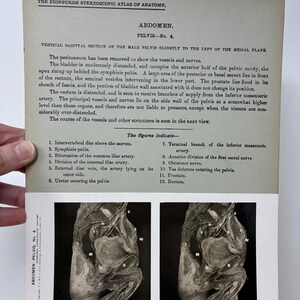 May include: Anatomy illustration from "The Edinburgh Stereoscopic Atlas of Anatomy" showing a vertical sagittal section of the male pelvis. The image includes text describing the anatomical structures and a list of figures.