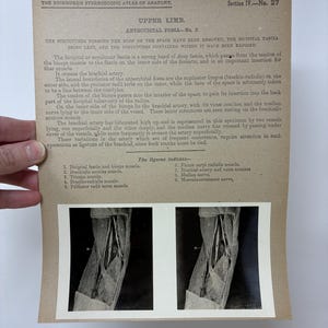 May include: Anatomy illustration from the Edinburgh Stereoscopic Atlas of Anatomy. The image shows a detailed black and white anatomical study of the upper limb, specifically the antecubital fossa. Text details the structures and muscles.