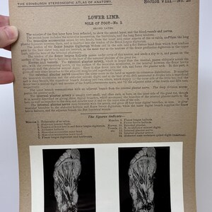 May include: Anatomy illustration of the lower limb, sole of the foot, with detailed views of muscles, tendons, nerves, and arteries. The image is from the Edinburgh Stereoscopic Atlas of Anatomy, section VIII, No. 28.