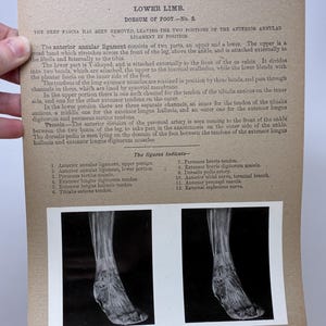 May include: Anatomy illustration from the Edinburgh Stereoscopic Atlas of Anatomy, Section VIII, No. 20. The image shows a detailed black and white photograph of a foot, with labels and text describing the lower limb's anatomy.