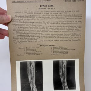 May include: Anatomy study featuring a vintage print from the Edinburgh Stereoscopic Atlas of Anatomy. The print details the lower limb, front of the leg, with labeled diagrams of muscles, nerves, and vessels. Includes two black and white photographic images of the leg.