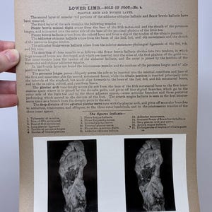 May include: Anatomy chart from the Edinburgh Stereoscopic Atlas of Anatomy, Section VIII, No. 29. The image shows a detailed black and white illustration of the sole of a foot, with labels and text describing the muscles and structures.