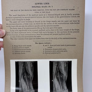 May include: Anatomy illustration from the Edinburgh Stereoscopic Atlas. The image features text describing the lower limb and popliteal space, along with two black and white anatomical diagrams. The diagrams show the muscles and nerves of the lower leg.