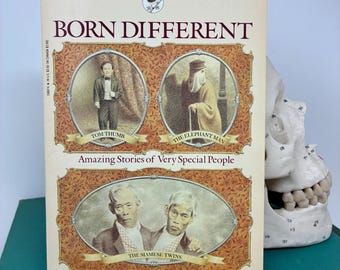1980s Book About Circus Sideshow Performers Human Genetic Abnormalities Siamese Twins - Born Different Paperback