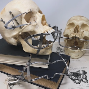 May include: Anatomical study featuring human skulls with antique surgical instruments attached. The skulls are positioned on a stack of old books and medical diagrams. The instruments are made of metal and appear to be designed for jaw or facial procedures.