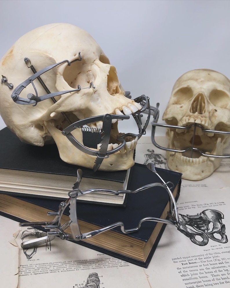 May include: Anatomical study featuring human skulls with antique surgical instruments attached. The skulls are positioned on a stack of old books and medical diagrams. The instruments are made of metal and appear to be designed for jaw or facial procedures.