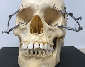 Eye Speculum - You Pick Amount: One or Pair! For Cosplay, Movie Prop, Medical Collection, Halloween, Art