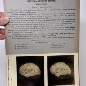 May include: Anatomy illustration from the Edinburgh Stereoscopic Atlas of Anatomy, Section I, No. 25. The image shows a detailed diagram of the central nervous system, specifically the brain's insula. The text describes the brain's structure and features.