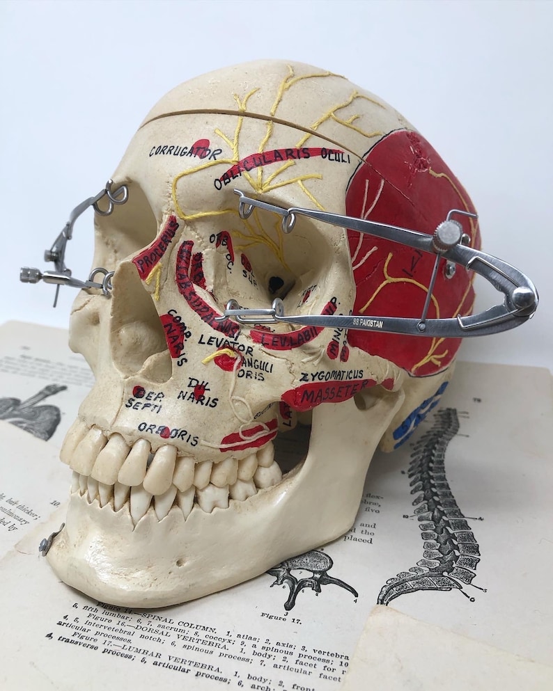 May include: A plastic anatomical skull model with painted muscle markings and a set of calipers. The skull is resting on a page from a medical textbook with illustrations of the human spine and other anatomical structures. The text on the page includes the words "SPINAL COLUMN", "DORSAL VERTEBRA", and "LUMBAR VERTEBRA".