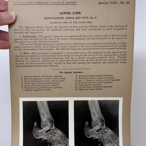 May include: Anatomy chart from The Edinburgh Stereoscopic Atlas of Anatomy, Section VIII, No. 30, featuring illustrations of the lower limb, specifically the ankle and foot. The chart includes detailed diagrams and descriptions of ligaments.