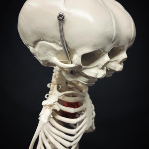 Réplique de squelette humain fœtal de jumeaux siamois sur pied avec véritable crâne triclops coeur d'animal image 6