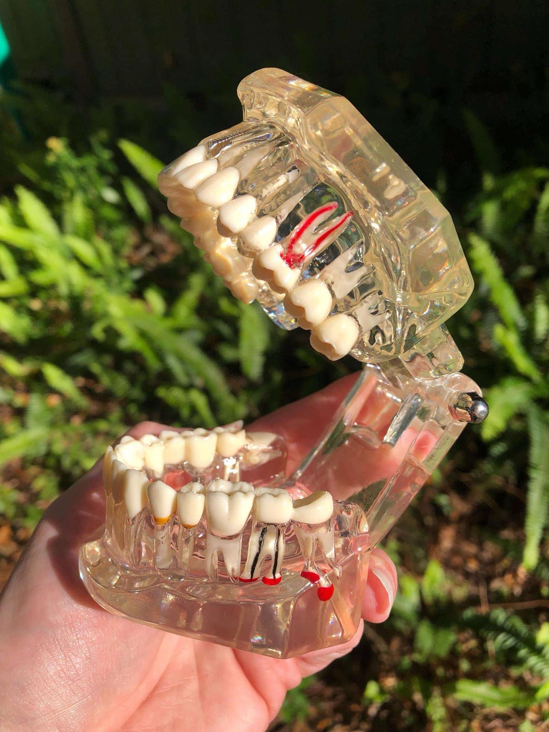 Clear Dental Model for Educational or Display Purposes - Human Dental Disease, Tooth Decay, Impacted Wisdom Teeth - Cosplay or Movie Prop