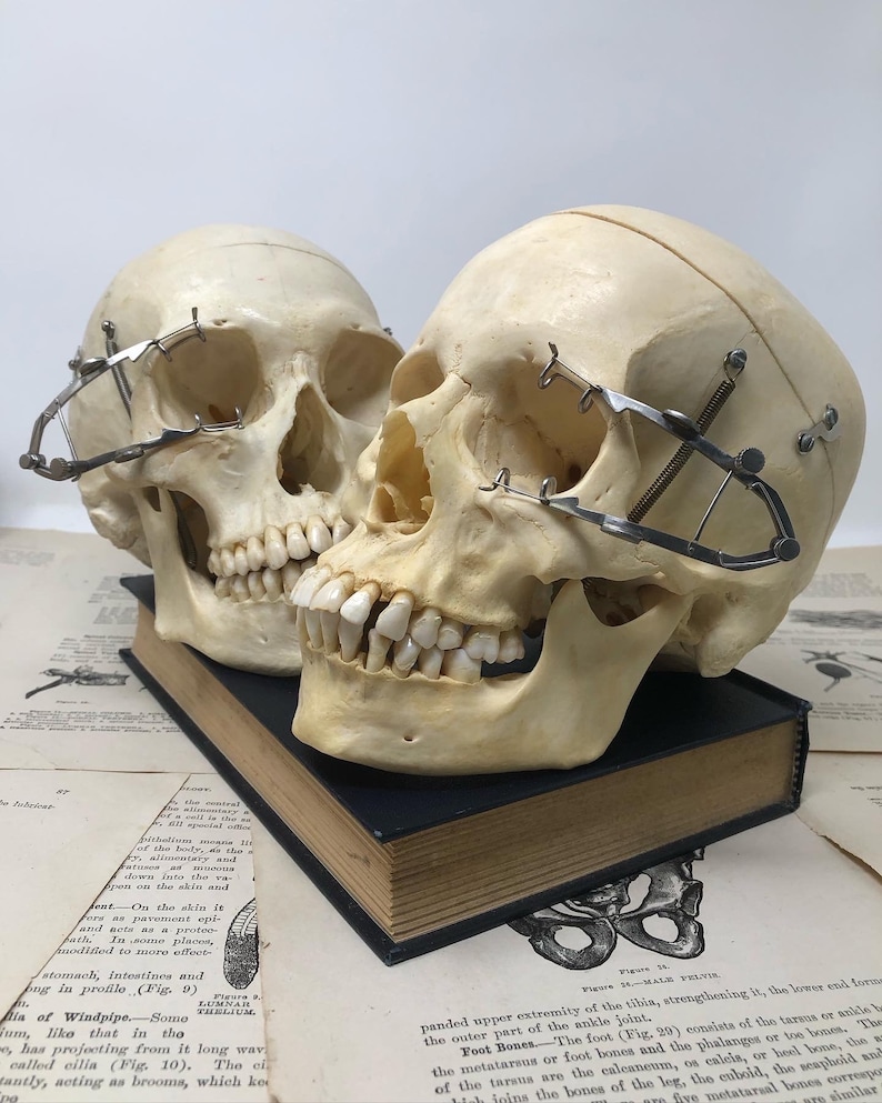 May include: Two anatomical human skulls with metal clamps attached to the eye sockets. The skulls are positioned side-by-side, with the skull on the right leaning slightly towards the skull on the left. The skulls are resting on a black book.