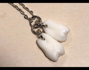 YOU SUPPLY TOOTH (1, 2 or 3) Your Supplied Tooth/Teeth Made Into a Pendant Necklace - Human or Large Pet Canine