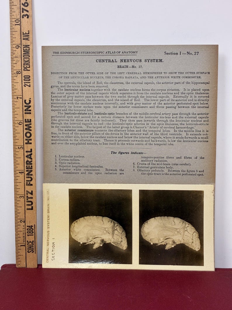 Brain Ruler 1905 Human Brain Dissection Medical Stereoview Card - Central Nervous ...