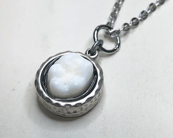 YOUR SUPPLIED TOOTH - Made Into Antique Silver Hammered Metal Setting Pendant Necklace - Silver Option