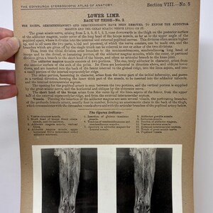 May include: Anatomy illustration from the Edinburgh Stereoscopic Atlas, showing the lower limb's back of thigh muscles. The text details the biceps, semimembranosus, and semitendinosus muscles. Includes labeled figures and anatomical details.