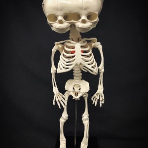Réplique de squelette humain fœtal de jumeaux siamois sur pied avec véritable crâne triclops coeur d'animal image 4